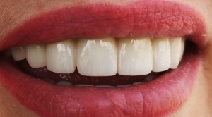 2 - ccdf2b15-5c08-4921-8194-e8ea0cef0844.jpg